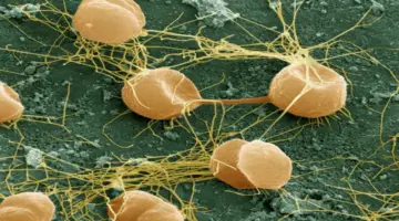 “بيروكوكوس”… حياة على حافة الغليان